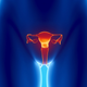 Illustration for article titled FDA Criticized For Approving Controversial Vaginal Mesh